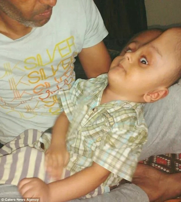 Toddler with 73cm brain receives lifesaving help from strangers Toddler with 73cm brain receives lifesaving help from strangers