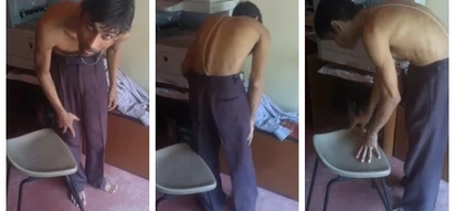 Nagmamakaawa po siya. PWD in critical condition humbly begging for help with treatment for spinal cord damage