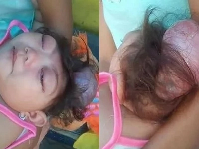 Sobrang nakakaiyak! Heartbreaking photos of dying 1-year-old Pinay girl in Mandaluyong City go viral