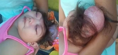Sobrang nakakaiyak! Heartbreaking photos of dying 1-year-old Pinay girl in Mandaluyong City go viral