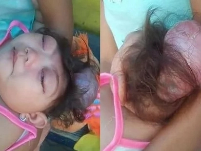 Sobrang nakakaiyak! Heartbreaking photos of dying 1-year-old Pinay girl in Mandaluyong City go viral