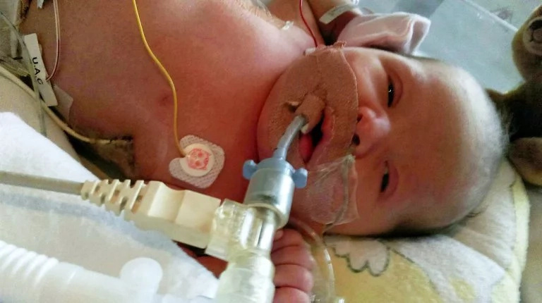 This Baby Was Born With WATER Instead Of Blood (Photo) This Baby Was Born With WATER Instead Of Blood (Photo)
