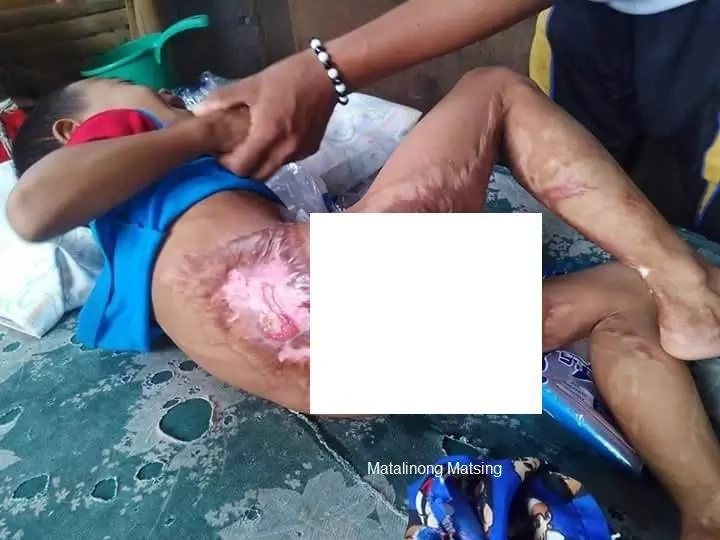 Netizens concerned with poor boy's condition Netizens concerned with poor boy's condition