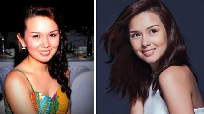 PLASTIC-SURGERIES PLASTIC-SURGERIES