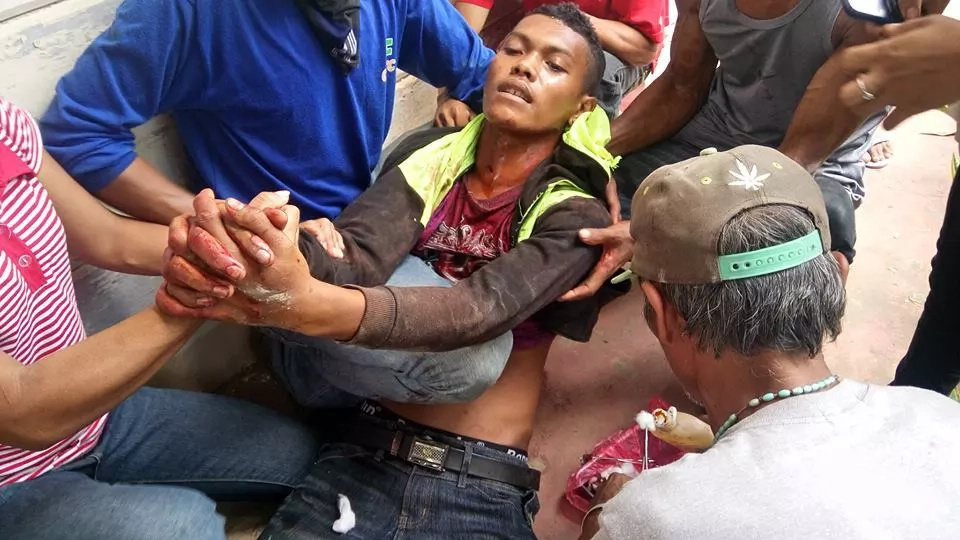 3 Dead, 116 Others Wounded In Cotabato Rally 3 Dead, 116 Others Wounded In Cotabato Rally