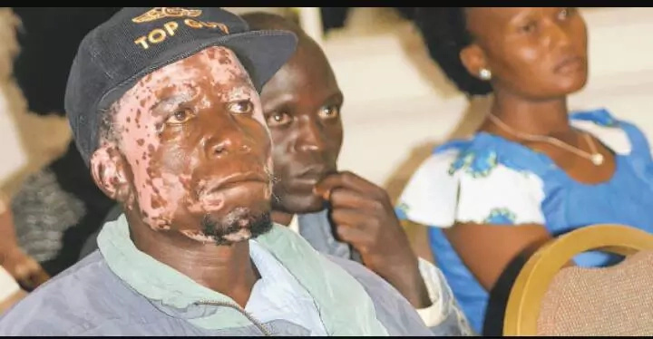 Photos: See how Orengo used election violence victim to get sympathy from crowd