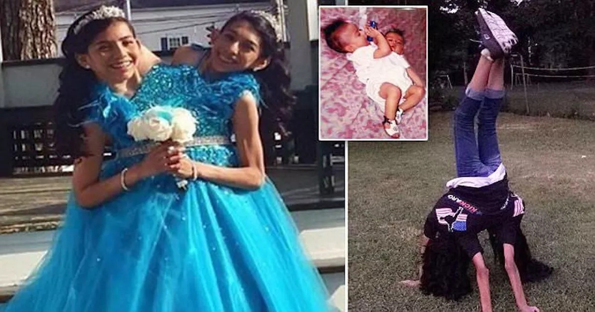 See extraordinary life of CONJOINED twins, 16, who share organs and refuse to be separated (photos, video)