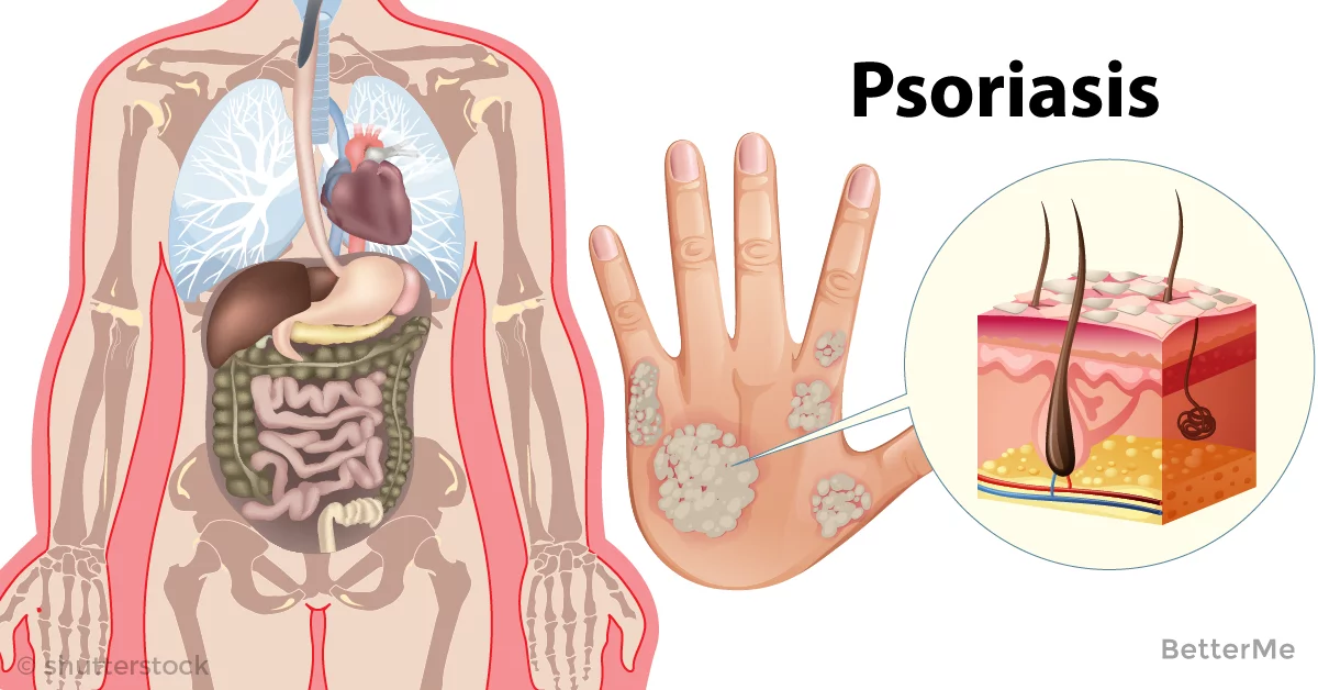 Your and immune system diseases may cause