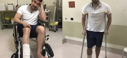 “So Yes, i have a fractured foot with quite a long healing time..” Luis Manzano On Instagram