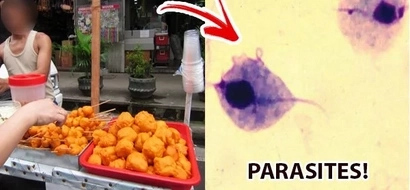 This girl finds three awful parasites in her stomach. She got them from eating her favorite street food!
