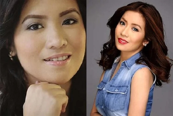 Pinay celebrities who are proud to have undergone cosmetic surgeries Pinay celebrities who are proud to have undergone cosmetic surgeries