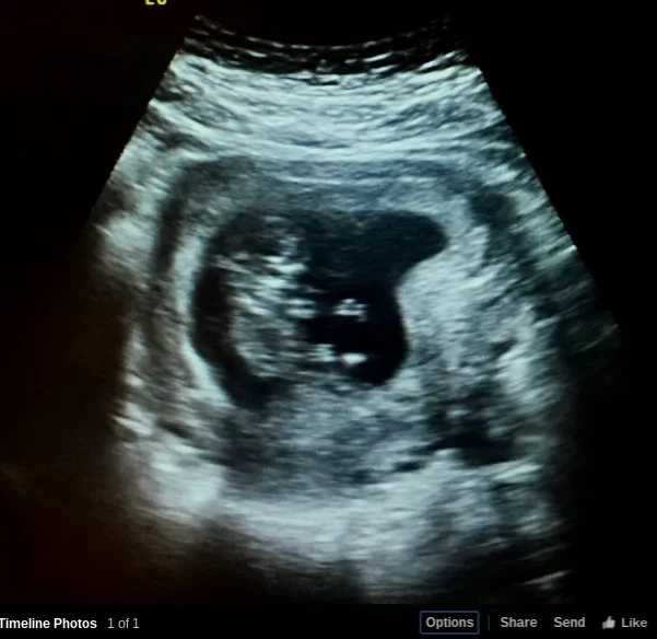 Husband shares a funny but emotional post about wife’s pregnancy struggle Husband shares a funny but emotional post about wife’s pregnancy struggle