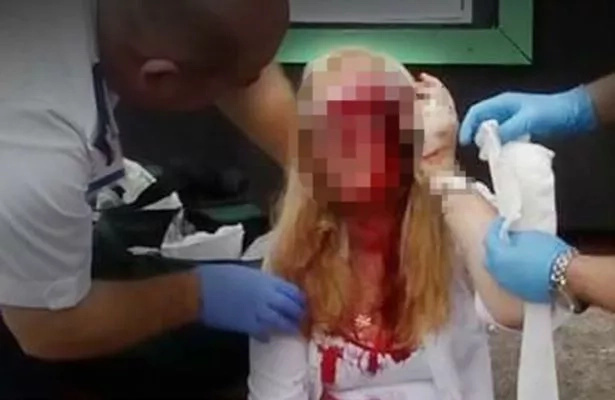 See the consequences of a horrific hammer attack on a woman! See the consequences of a horrific hammer attack on a woman!