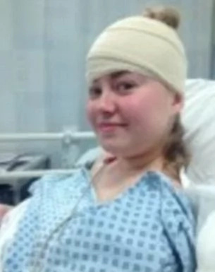 Mother blames daughter’s death to not applying sunscreen lotion Mother blames daughter’s death to not applying sunscreen lotion