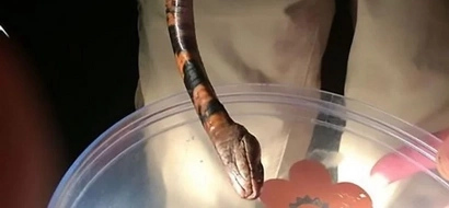 Boy Survived Bite From Most Venomous Snake In The World And Keeps It In A Jar Now