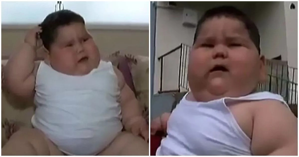 This 31kg toddler who is constantly hungry now on verge of death and his parents can't do anything about it (photos)
