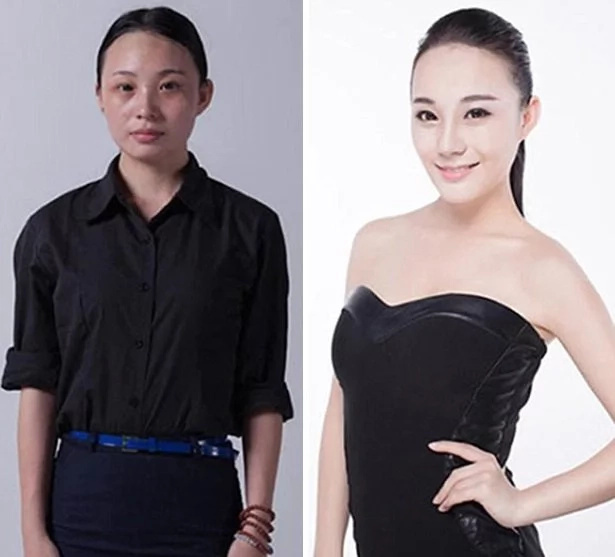 These women tried plastic surgery. The result? Shocking! These women tried plastic surgery. The result? Shocking!