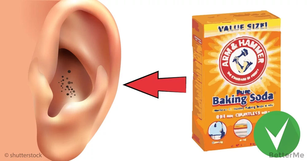 How To Remove Blackheads From Ears With Baking Soda