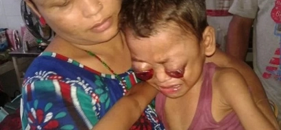 This child's eyes bleed and pop out of his skull! His parents are shocked!