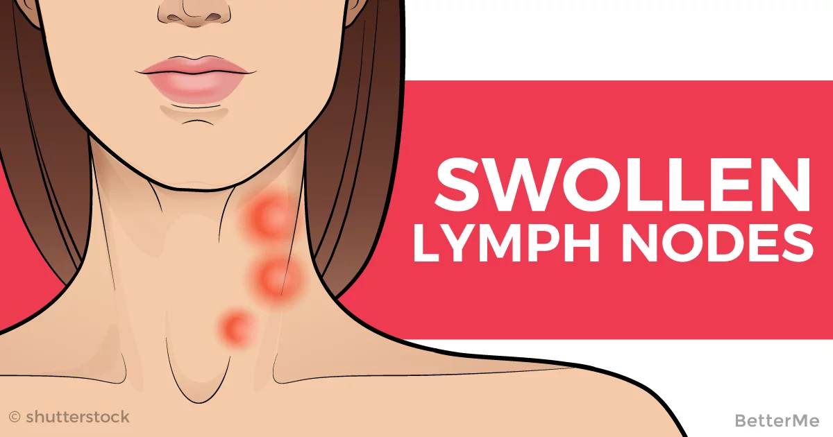 back neck lymph nodes swollen