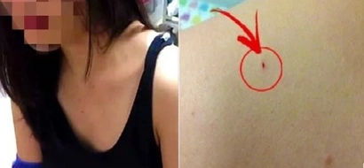 Netizen fears AIDS after unnamed woman pricked her with a needle in Cubao
