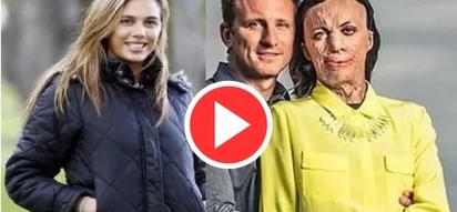 VIDEO: This model suffered severe BURNS; but what her boyfriend did will melt your heart