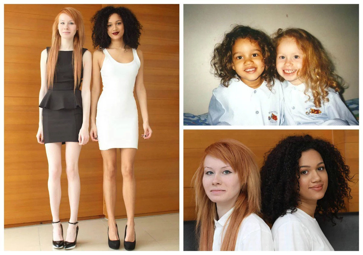 Meet Black And White Twin Sisters Born With Different Skin Colour (photos)