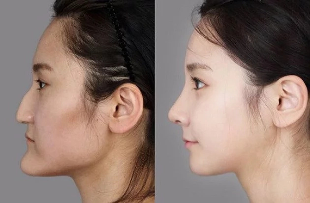 These women tried plastic surgery. The result? Shocking! These women tried plastic surgery. The result? Shocking!