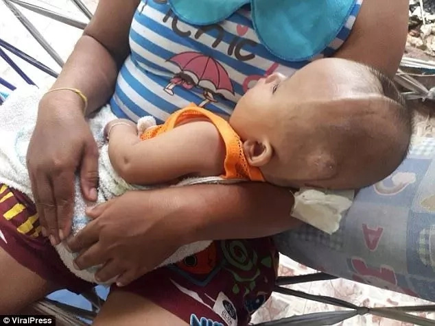 Tragedy as parents abandon 8-month old toddler living with a two-inch deep crack in the top of his head Tragedy as parents abandon 8-month old toddler living with a two-inch deep crack in the top of his head