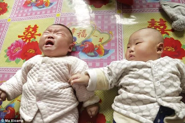 The twin boys both suffer from congenital heart disease and pneumonia The twin boys both suffer from congenital heart disease and pneumonia