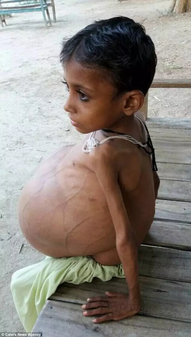 As a result, Shah's stomach is bloated As a result, Shah's stomach is bloated