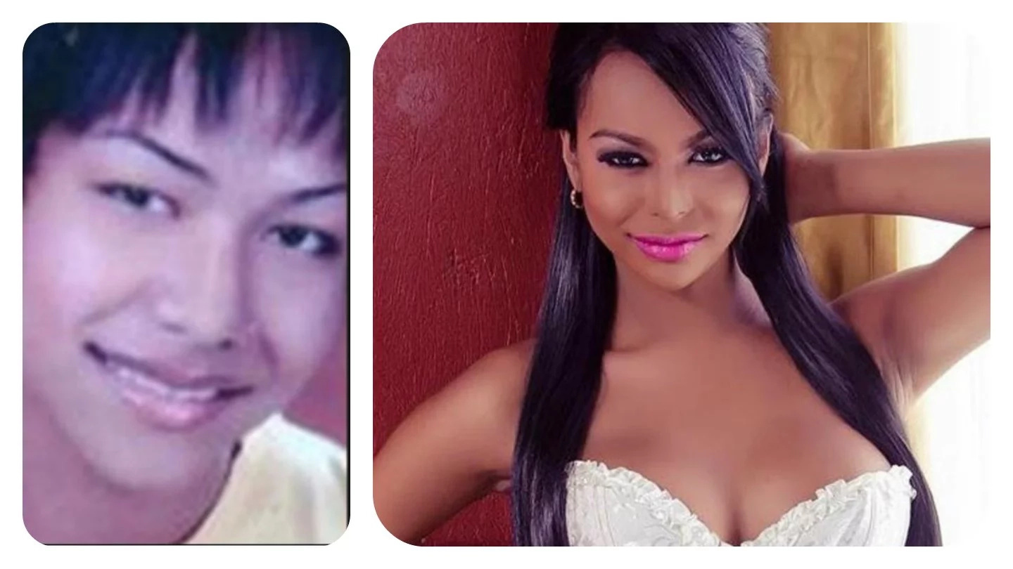6 Remarkable Pinoy Transgender Before And After Surgery KAMICOMPH