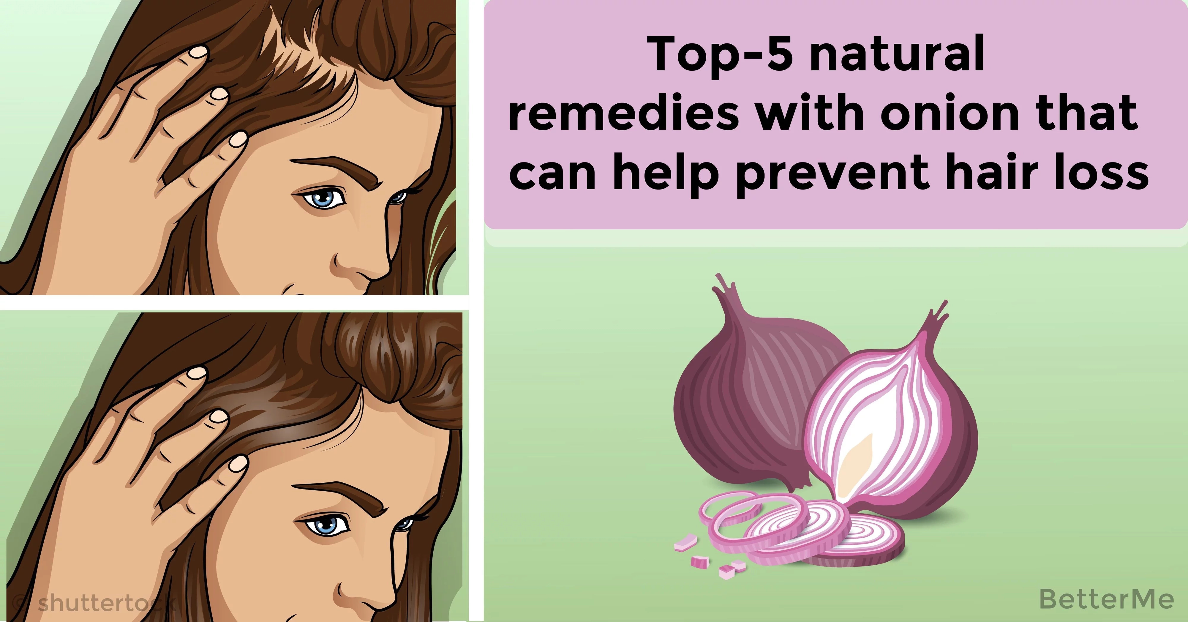 Top 5 Natural Remedies With Onion That Can Help Prevent Hair Loss