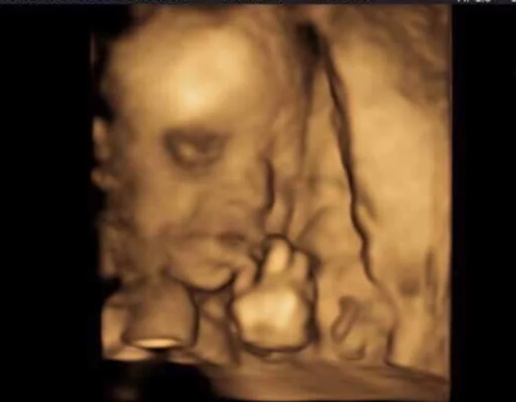 Buboy Villar is going to be a daddy soon! Buboy Villar is going to be a daddy soon!