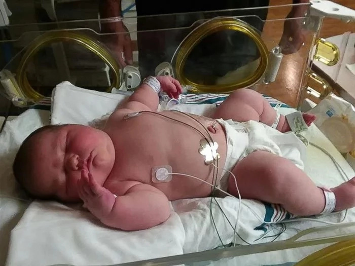 Mother gave birth to a 13.5 lbs (6kg) baby. The baby's so big that she felt like a toddler is coming out of her belly! Mother gave birth to a 13.5 lbs (6kg) baby. The baby's so big that she felt like a toddler is coming out of her belly!