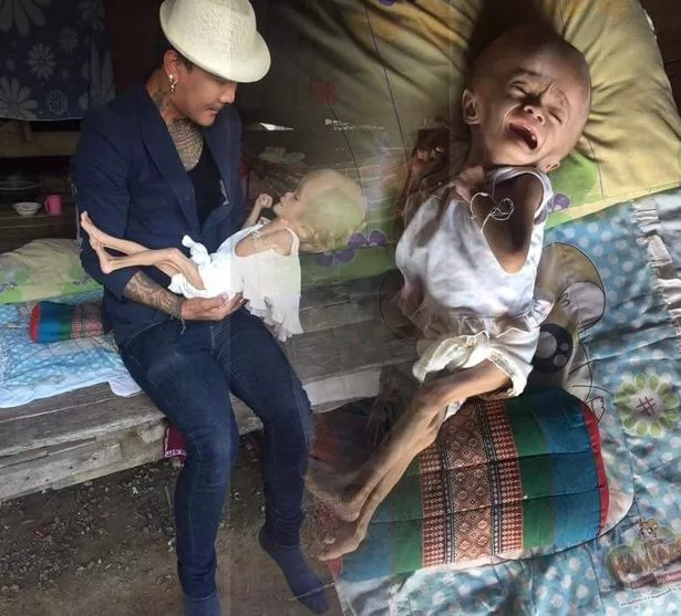 See 2-year-old girl who was born with oversized head in desperate need of help (photos) See 2-year-old girl who was born with oversized head in desperate need of help (photos)