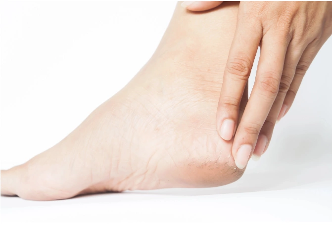 Top 10 signs of aging that can be undone Top 10 signs of aging that can be undone