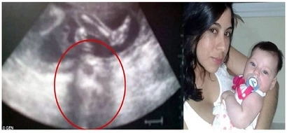 Know the story! Jesus Christ’s face appeared on ultrasound!