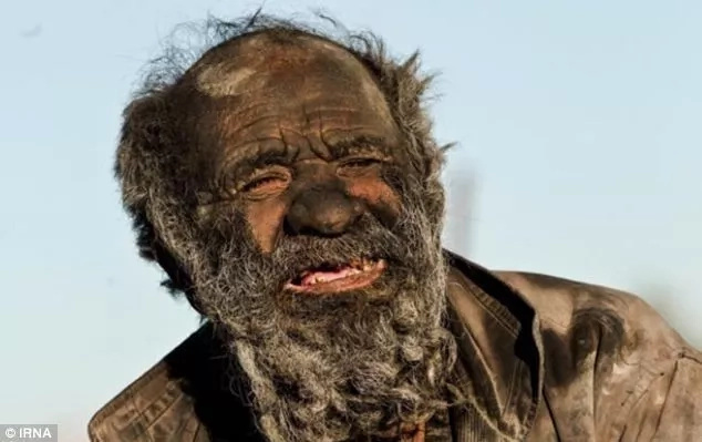 Man, 80, hasn't bathed for 60 years (photos, video) Man, 80, hasn't bathed for 60 years (photos, video)