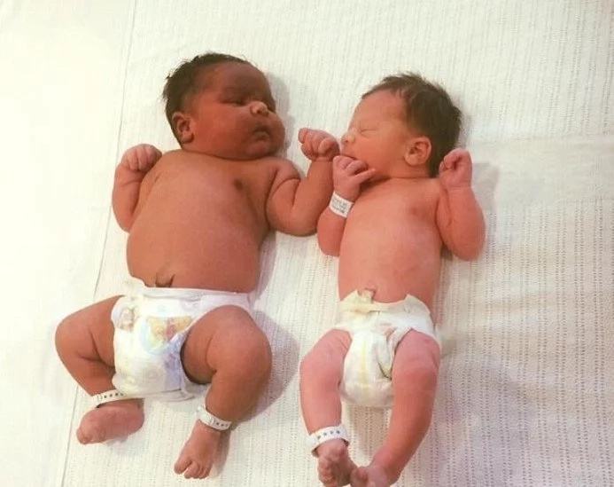 Australian Woman Gives Birth To MASSIVE 6 Kilogram Babby! (Photos) Australian Woman Gives Birth To MASSIVE 6 Kilogram Babby! (Photos)