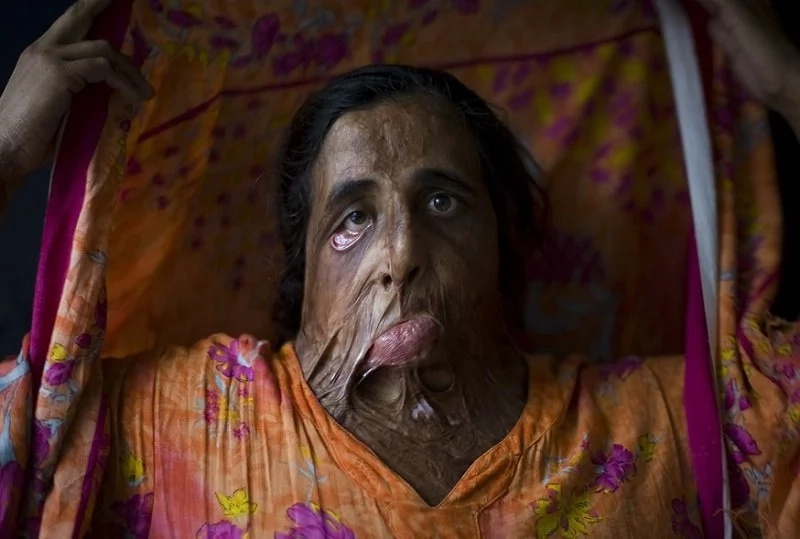 These Pakistani women rejected marriage proposals and you will be shocked what they got in return These Pakistani women rejected marriage proposals and you will be shocked what they got in return