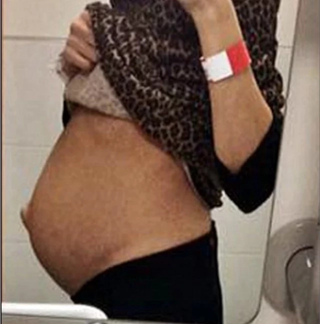 Woman was "pregnant" for 10 YEARS before doctors did THIS (photos)