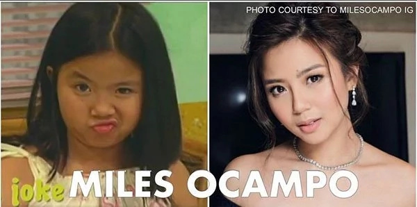 Gandang di mo inakala!Awkward pinoy childstars who became gorgeous Gandang di mo inakala!Awkward pinoy childstars who became gorgeous