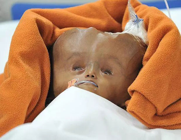 Dying child outlives parents' predictions about her life Dying child outlives parents' predictions about her life