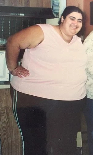 Woman’s fats save her life Woman’s fats save her life