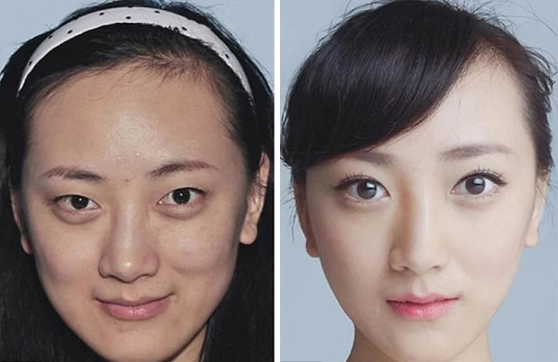 These women tried plastic surgery. The result? Shocking! These women tried plastic surgery. The result? Shocking!
