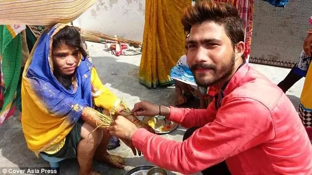 Kavita had to go through a long period of treatment Kavita had to go through a long period of treatment