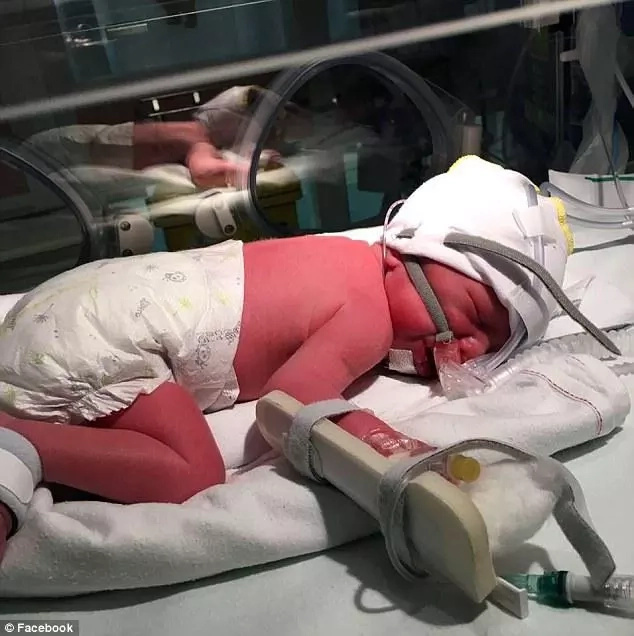 Heartbreaking! Mother carries dead son in her womb for 4 MONTHS so his twin brother could survive Heartbreaking! Mother carries dead son in her womb for 4 MONTHS so his twin brother could survive