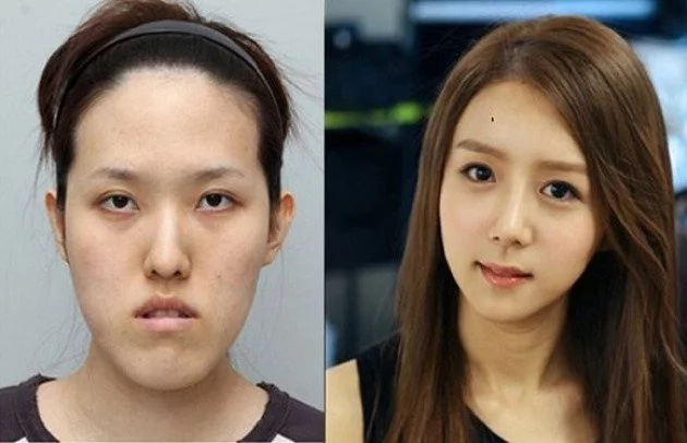 These women tried plastic surgery. The result? Shocking! These women tried plastic surgery. The result? Shocking!
