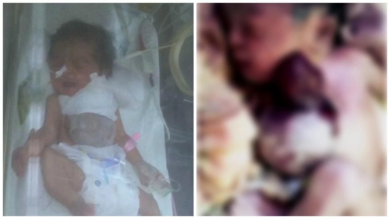 Parents in deep panic after their daughter is born with heart OUTSIDE her body (photos)
